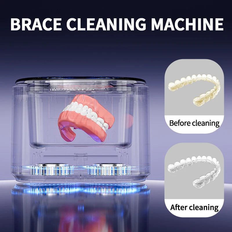 Aparat Curățare Dentară USB — Aparat Dentar, Bijuterii & Ochelari, Cadou Oral Care